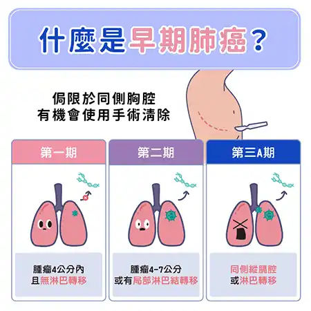 肺癌懶人包資訊圖 info001