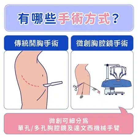 肺癌懶人包資訊圖 info002