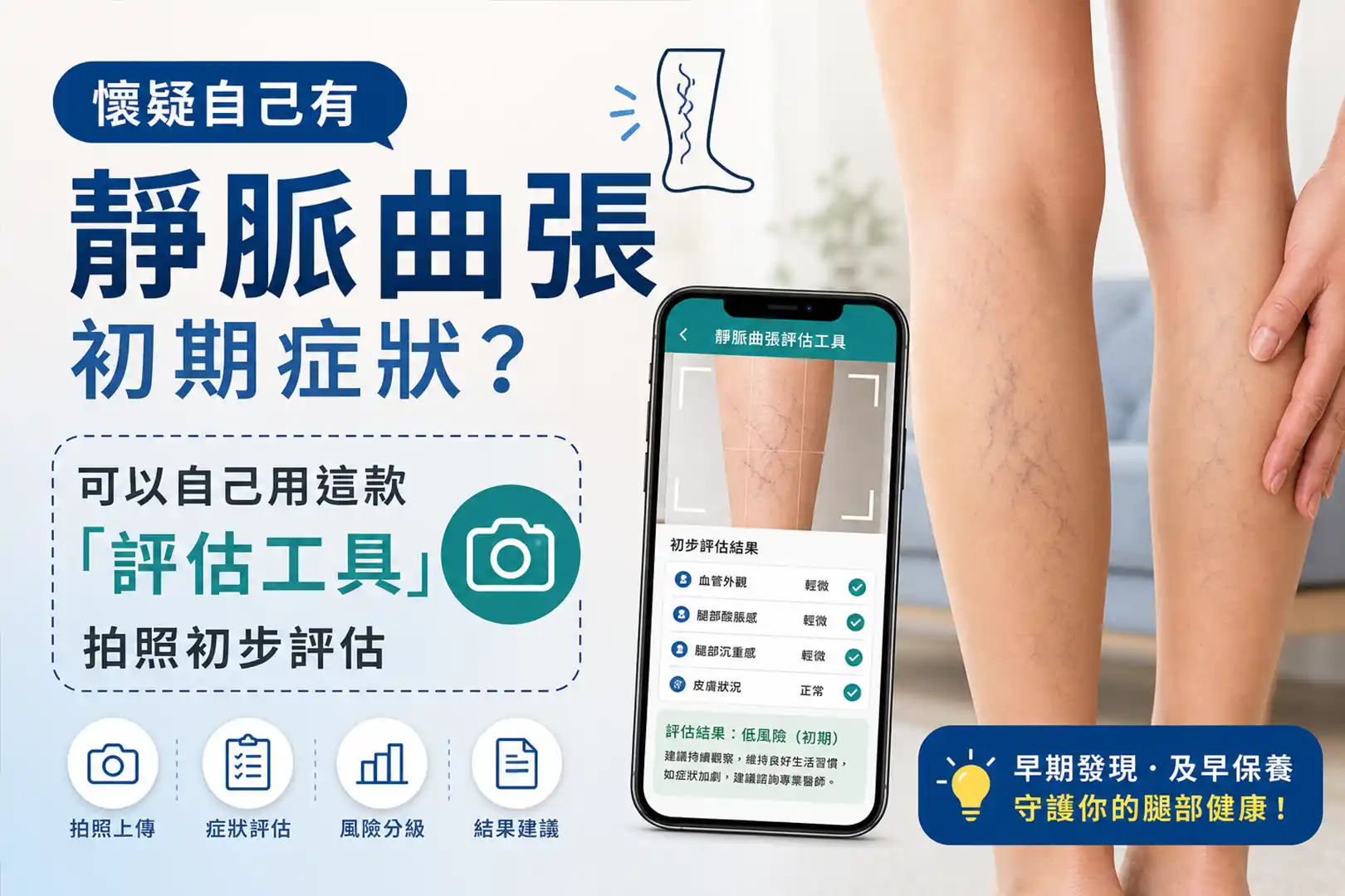 【醫療新知】靜脈曲張早期辨識有據可循　新型自我評估工具結合影像分析助民眾主動篩檢