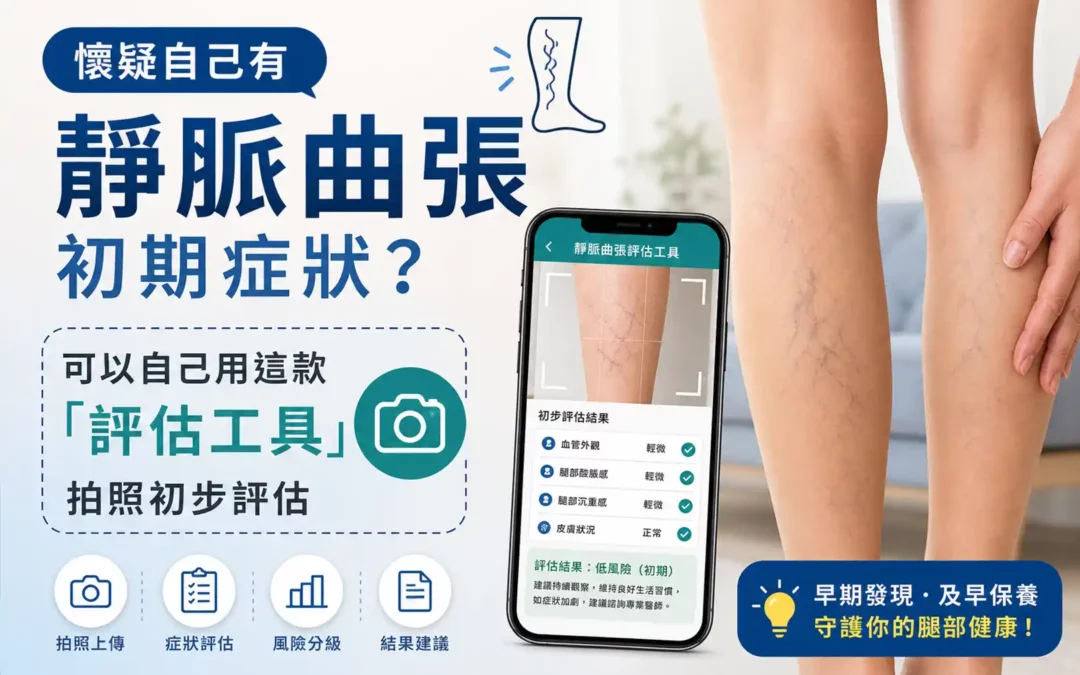 【醫療新知】靜脈曲張早期辨識有據可循　新型自我評估工具結合影像分析助民眾主動篩檢