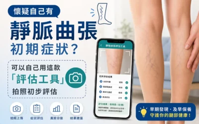 【醫療新知】靜脈曲張早期辨識有據可循 新型自我評估工具結合影像分析助民眾主動篩檢